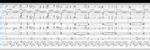 After Our Tomorrow&rsquo;s Are All Gone Arrangement 2 - Ronald Karle Music Composer and Arranger